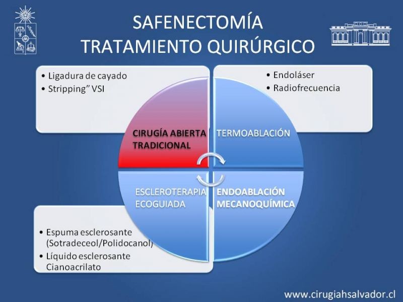 Diapositiva 16 de Safenectomía: técnica y resultados a largo plazo