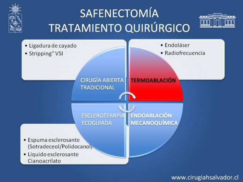 Diapositiva 21 de Safenectomía: técnica y resultados a largo plazo