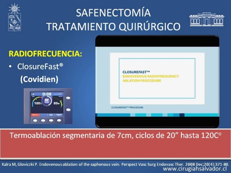 Diapositiva 28 de Safenectomía: técnica y resultados a largo plazo