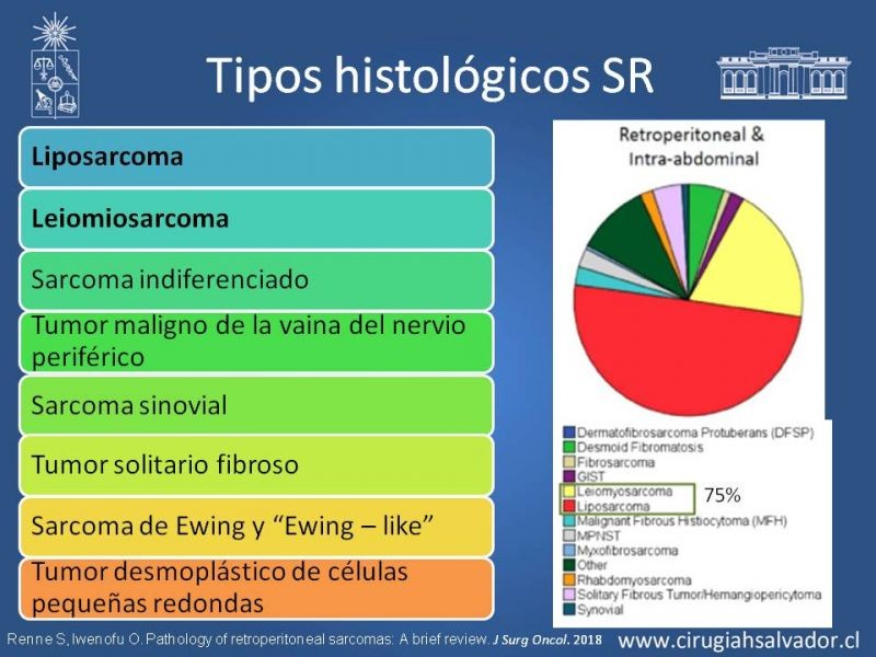 Diapositiva 7 de Sarcomas Retroperitoneales