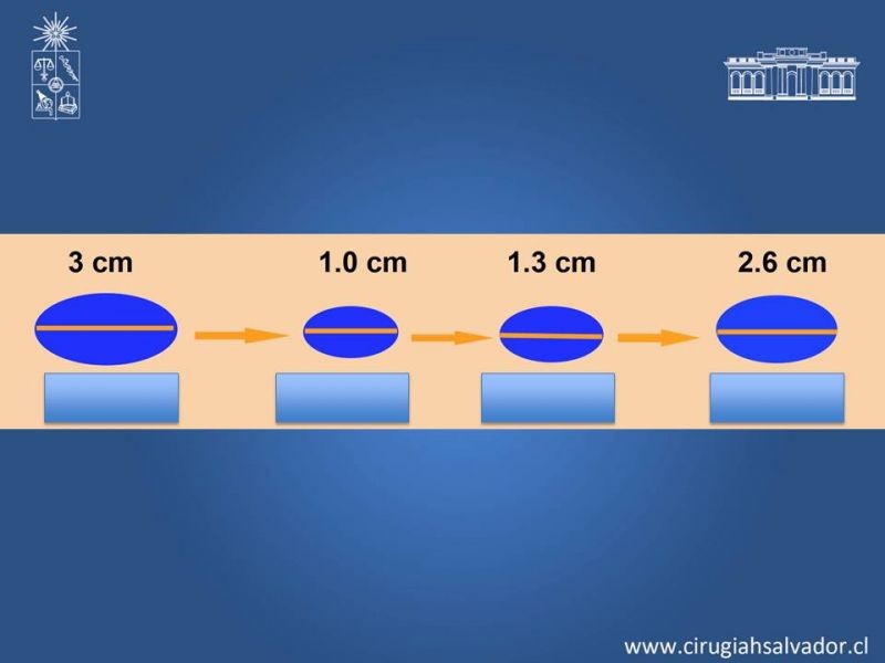 Diapositiva 19 de Criterios RECIST 1.1