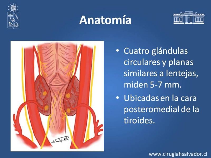 Diapositiva 1 de Hiperparatiroidismo 2°: Estudio, manejo e indic. Qx