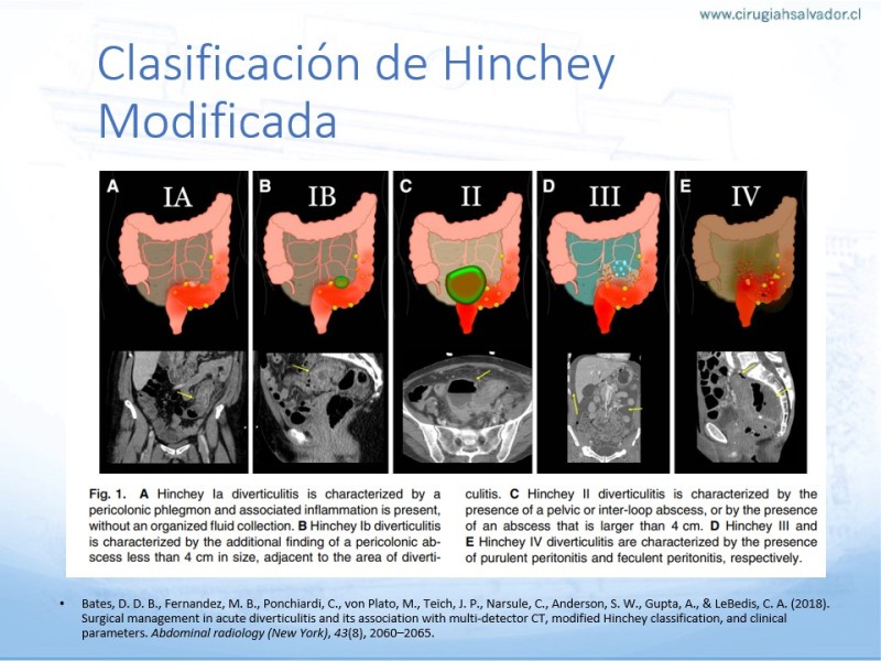 Presentaciones Depto Cirug a Hospital Del Salvador Presentaciones Depto Cirug a Hospital Del Salvador