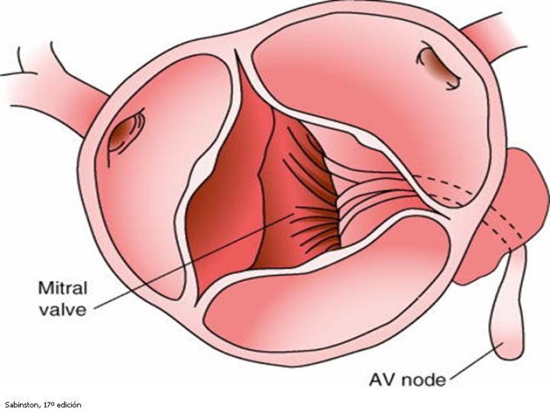 Diapositiva 40 de Valvulopatías
