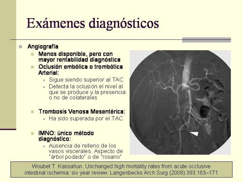 Diapositiva 17 de Isquemia Mesentérica Aguda