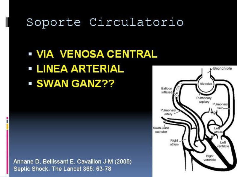 Diapositiva 37 de Shock
