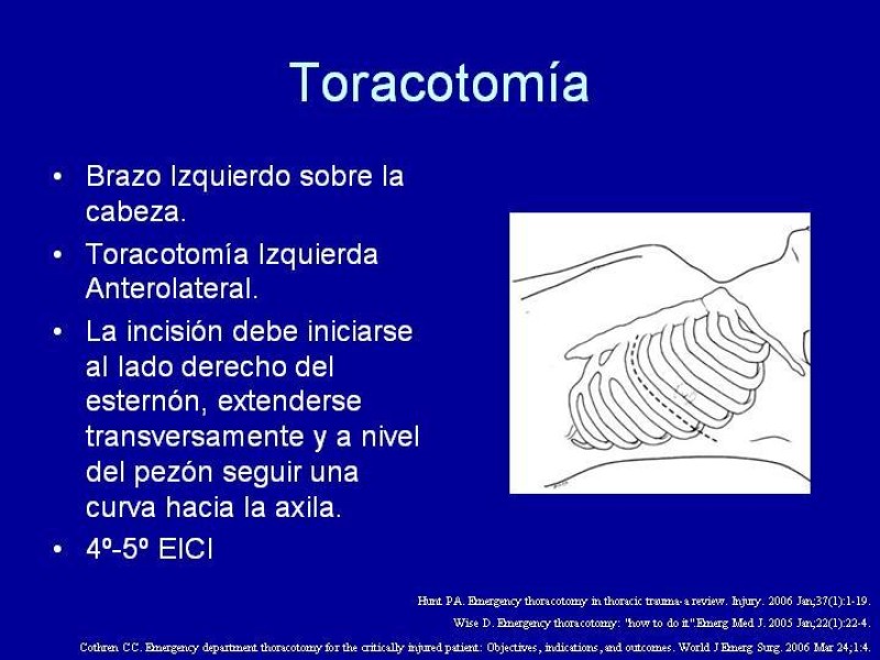 Diapositiva 19 de Toracotomía de Reanimación