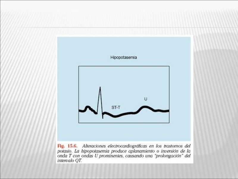 Diapositiva 35 de Manejo Hidroelectrolítico