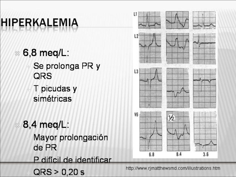 Diapositiva 40 de Manejo Hidroelectrolítico