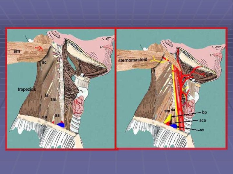 Diapositiva 15 de Disección Cervical Pt. 2