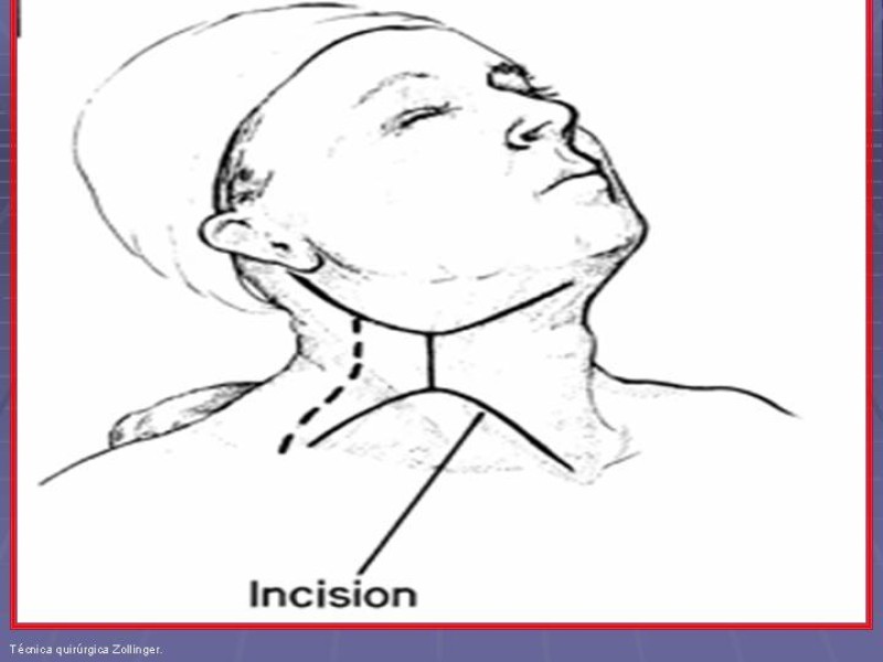 Diapositiva 5 de Disección Cervical Pt. 2