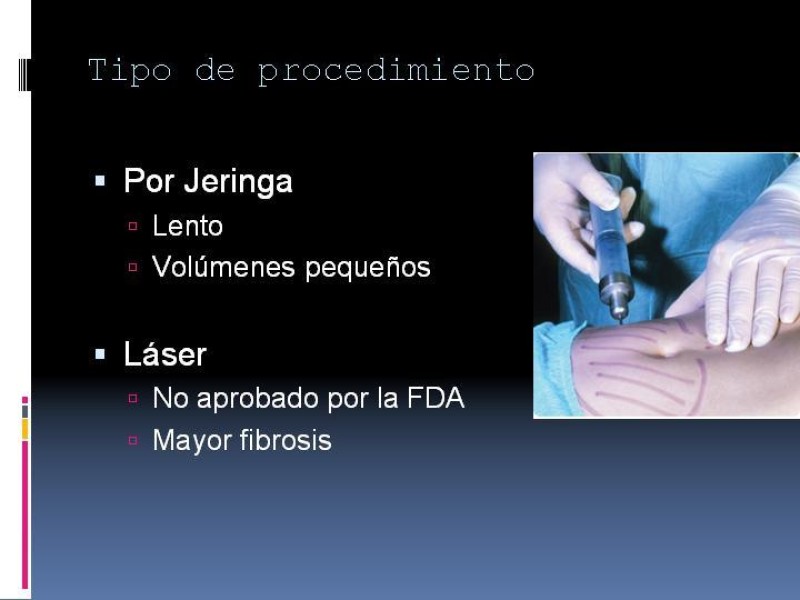 Diapositiva 25 de Liposucción