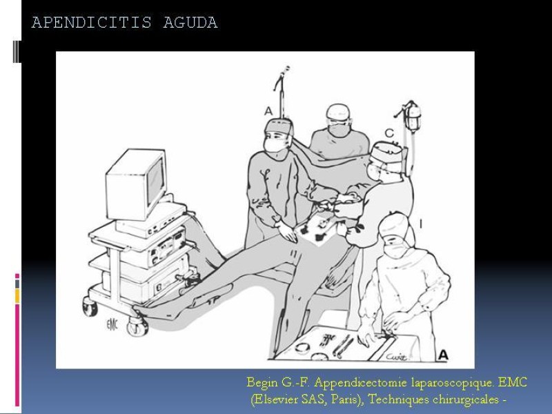 Diapositiva 29 de Apendicitis aguda