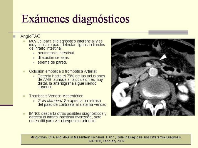 Diapositiva 14 de Isquemia Mesentérica Aguda