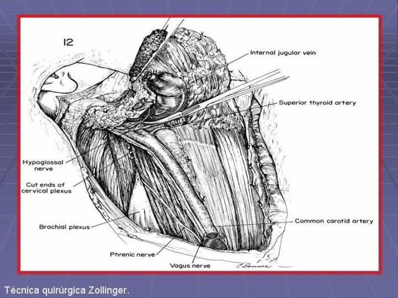 Diapositiva 28 de Disección Cervical Pt. 2