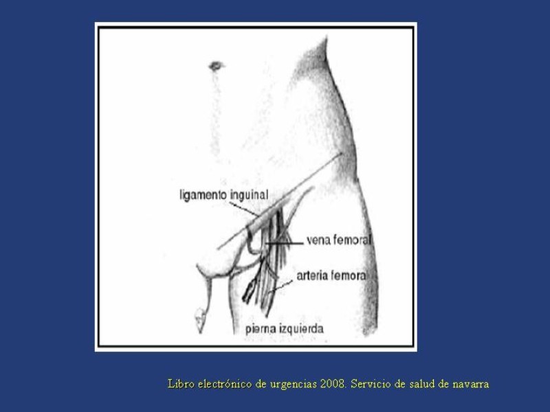 Diapositiva 16 de Accesos venosos centrales