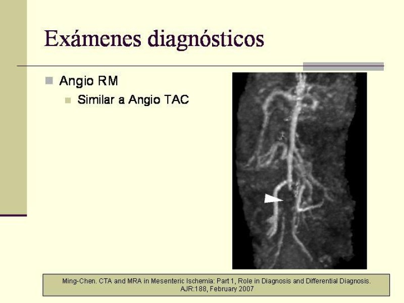 Diapositiva 16 de Isquemia Mesentérica Aguda