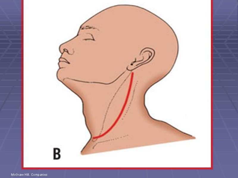 Diapositiva 8 de Disección Cervical Pt. 2