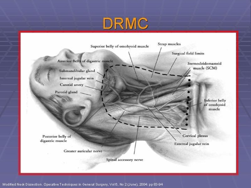 Diapositiva 38 de Disección Cervical Pt. 2