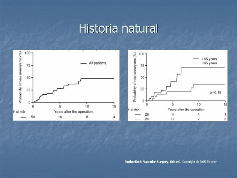 Diapositiva 11 de Aneurisma arterial poplíteo