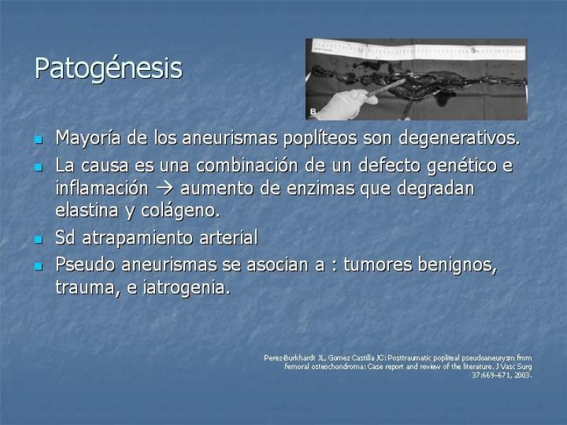 Diapositiva 5 de Aneurisma arterial poplíteo
