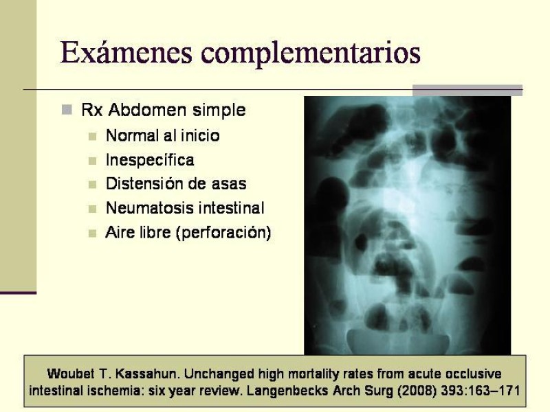 Diapositiva 13 de Isquemia Mesentérica Aguda
