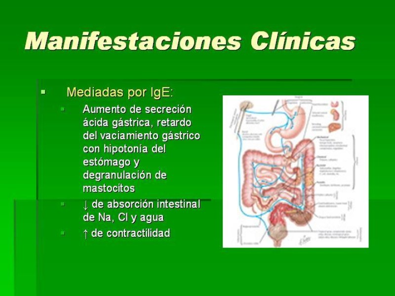Diapositiva 10 de Alergias alimentarias