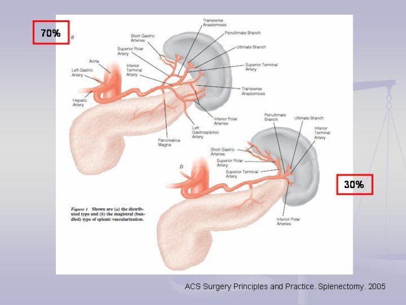 Diapositiva 6 de Técnica Quirúrgica Esplenectomía