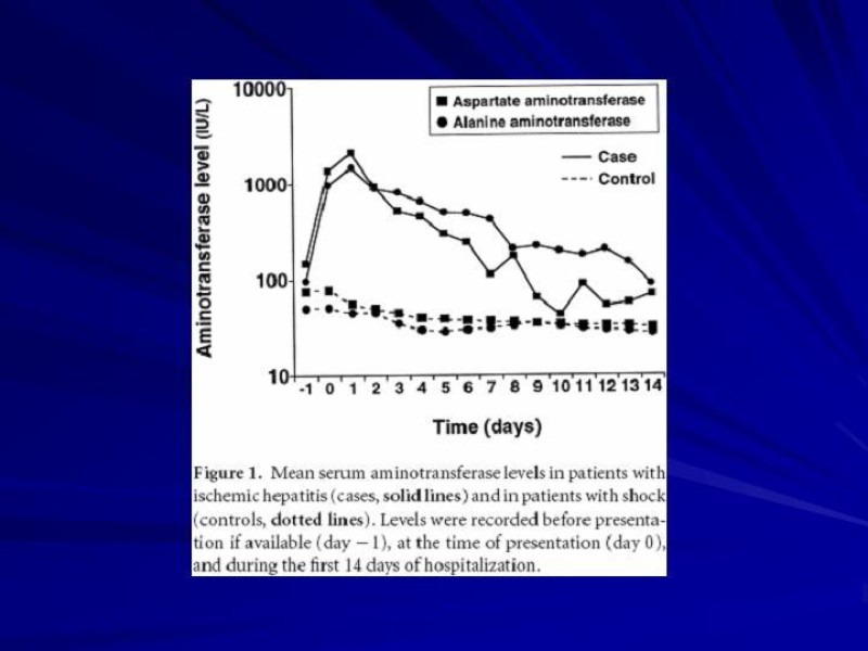 Diapositiva 20 de Hepatitis Isquémica