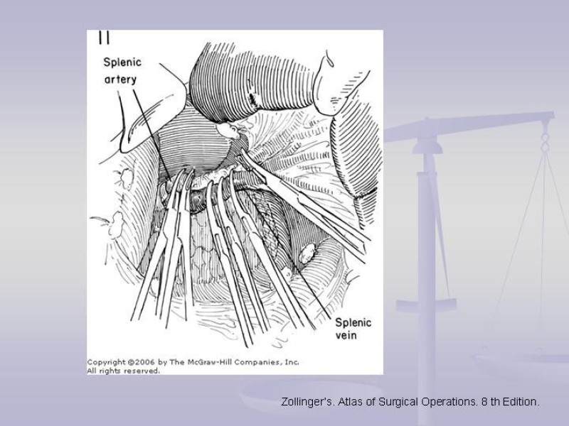 Diapositiva 23 de Técnica Quirúrgica Esplenectomía