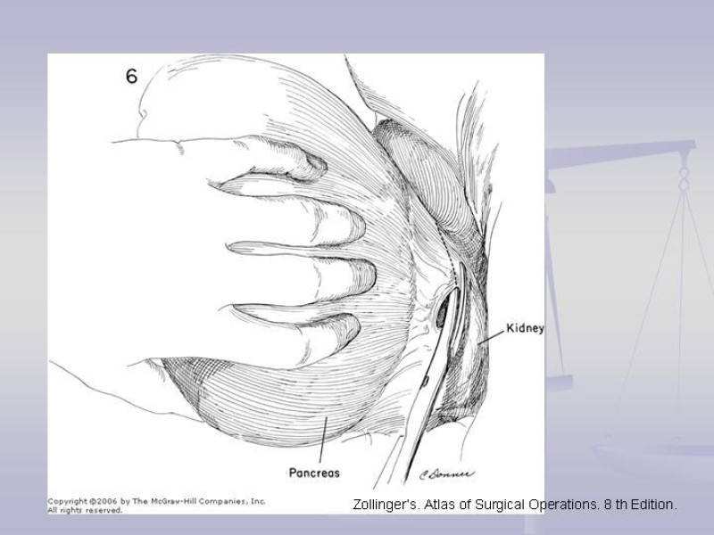 Diapositiva 21 de Técnica Quirúrgica Esplenectomía