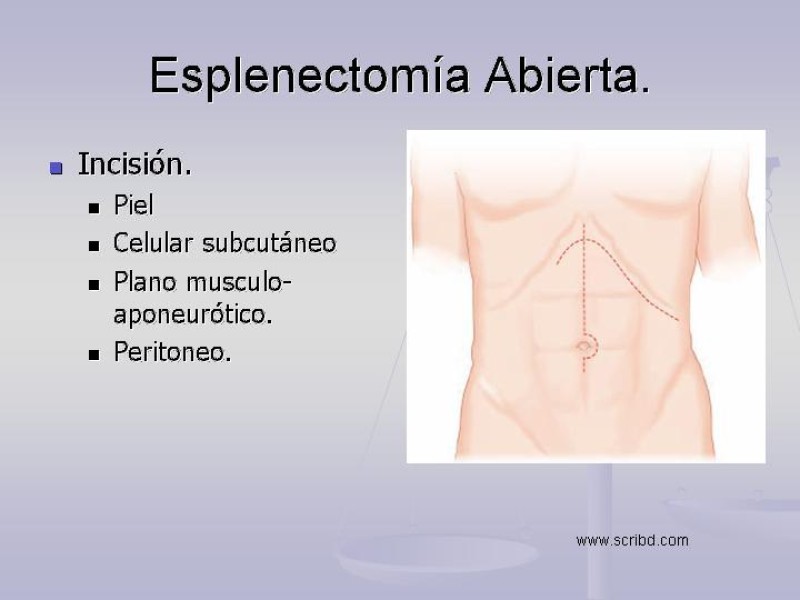 Diapositiva 11 de Técnica Quirúrgica Esplenectomía