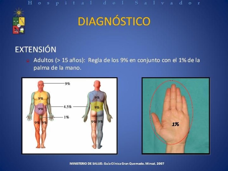 Diapositiva 7 de Gran Quemado