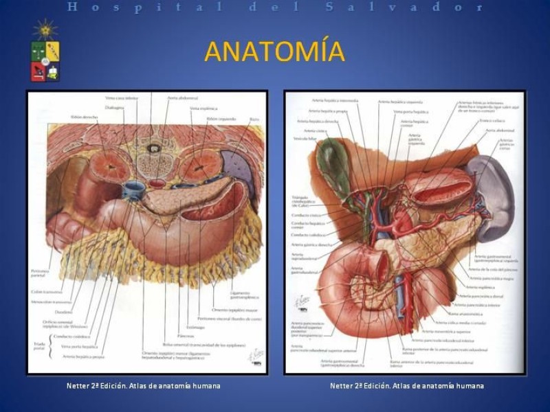 Diapositiva 6 de Trauma Duodenal