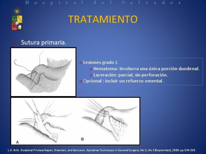 Diapositiva 23 de Trauma Duodenal