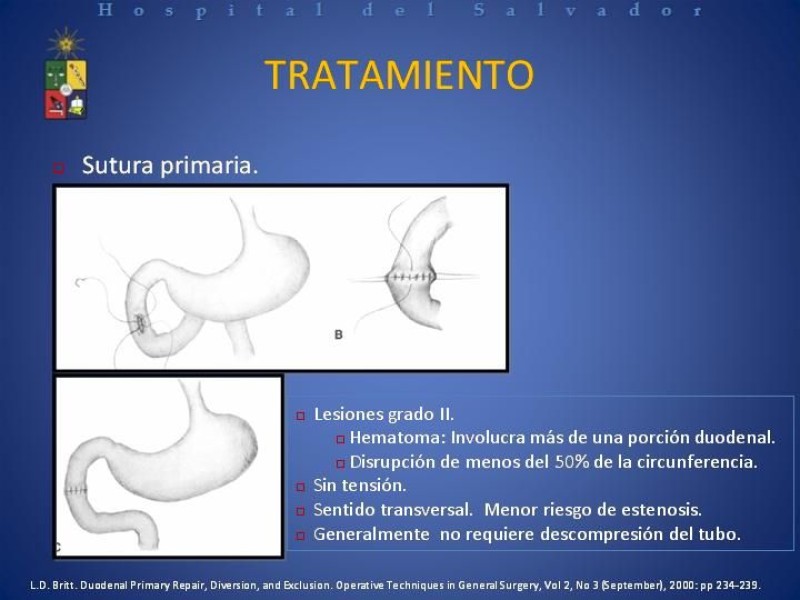 Diapositiva 24 de Trauma Duodenal