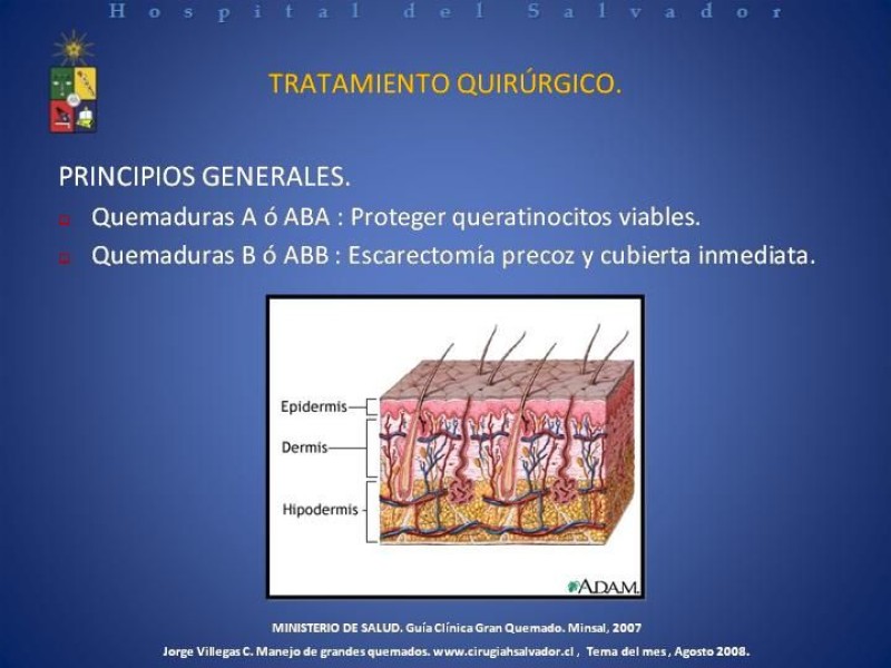 Diapositiva 25 de Gran Quemado