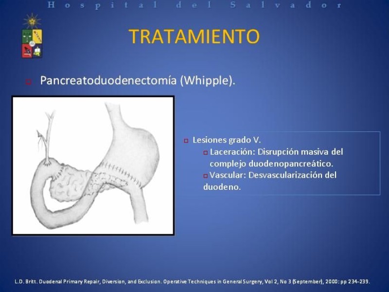 Diapositiva 29 de Trauma Duodenal