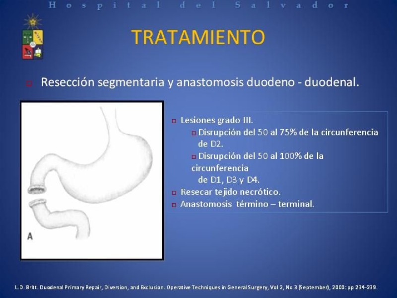 Diapositiva 25 de Trauma Duodenal