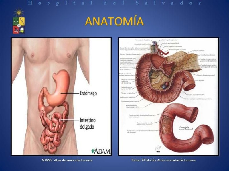 Diapositiva 5 de Trauma Duodenal