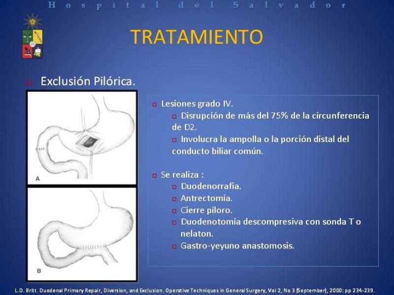 Diapositiva 27 de Trauma Duodenal
