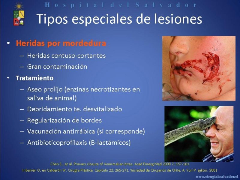 Diapositiva 16 de Evaluación y manejo de lesiones faciales