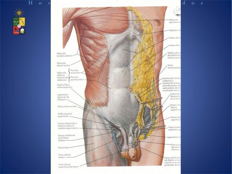 Diapositiva 6 de Técnica quirúrgica: Stoppa