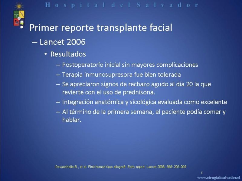 Diapositiva 3 de Transplante Facial