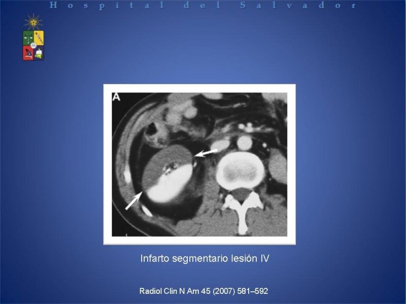 Diapositiva 10 de Trauma Renal