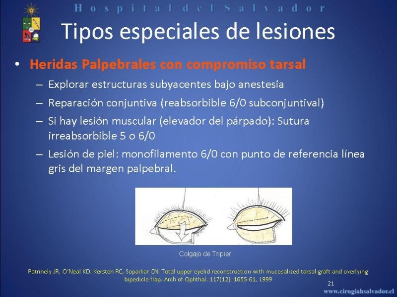 Diapositiva 20 de Evaluación y manejo de lesiones faciales