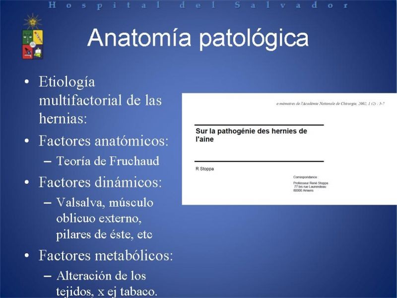 Diapositiva 4 de Técnica quirúrgica: Stoppa
