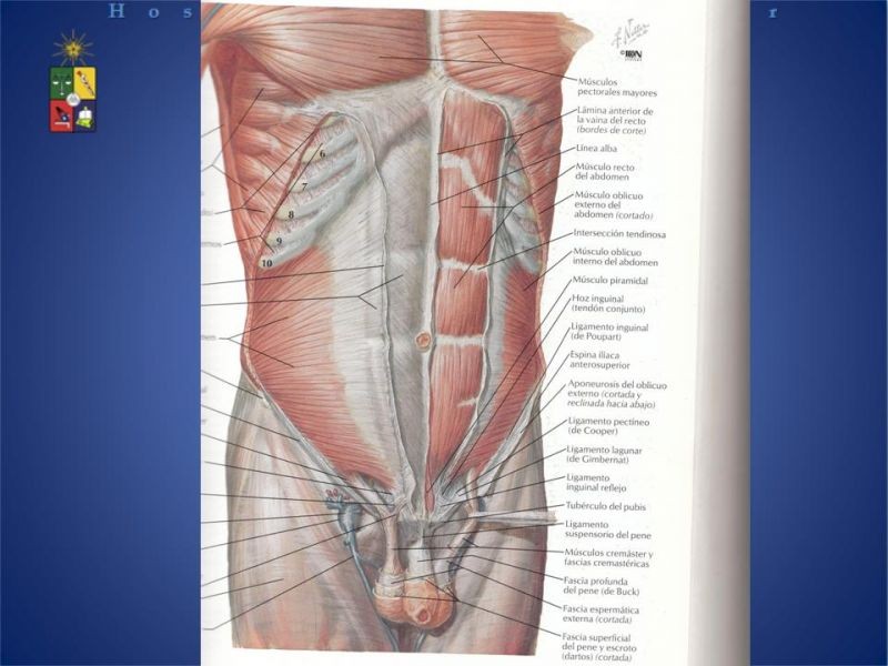 Diapositiva 7 de Técnica quirúrgica: Stoppa