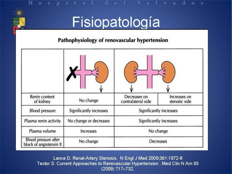 Diapositiva 5 de Hipertensión renovascular