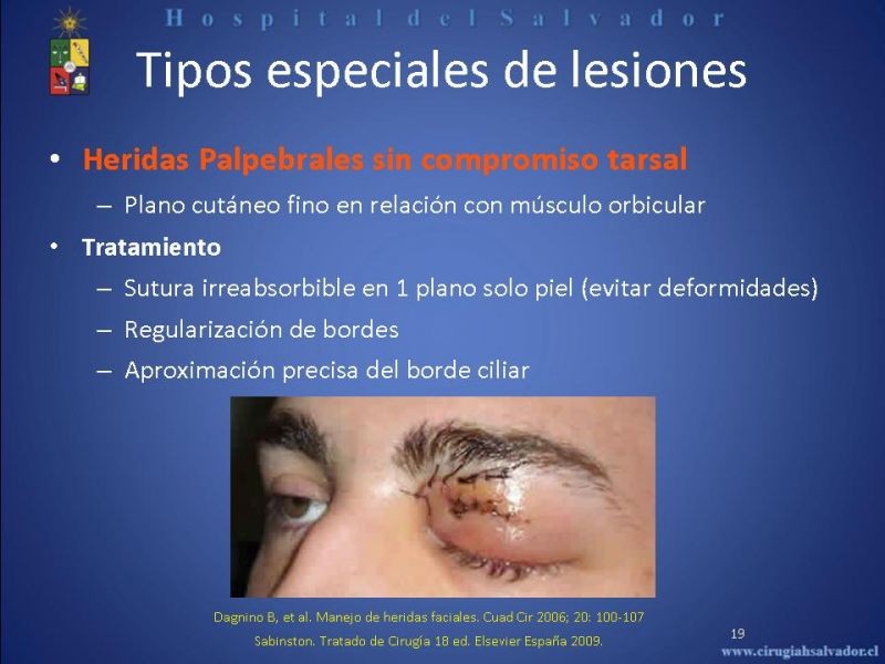 Diapositiva 18 de Evaluación y manejo de lesiones faciales